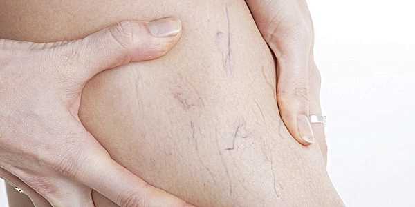 Bệnh nhân viên văn phòng thường mắc