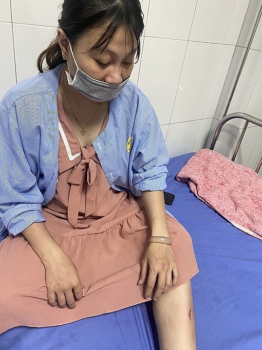 Vụ nổ tại Công ty Seojin Auto: May mắn của 2 công nhân mang thai giữa lằn ranh sinh tử