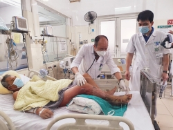 Chân hoại tử, nhiễm khuẩn huyết nguy kịch tính mạng sau khi vệ sinh khu nuôi tôm