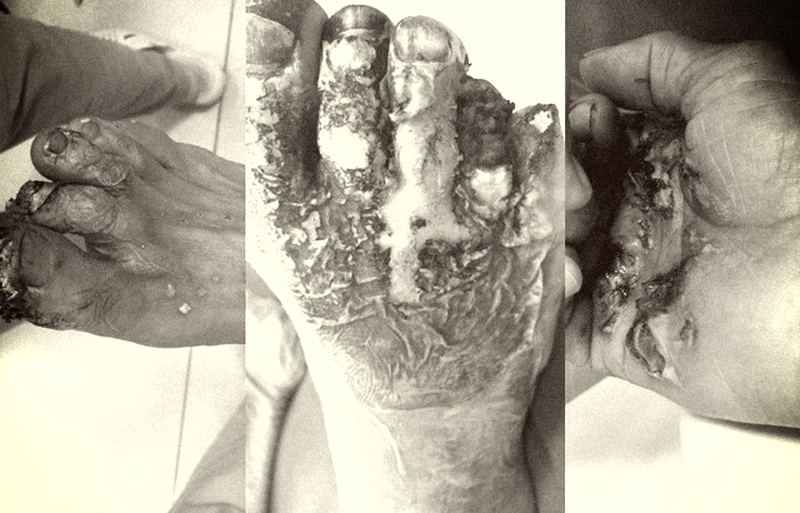 Câu cá dưới dòng điện cao thế - đừng “đùa giỡn” với tử thần!