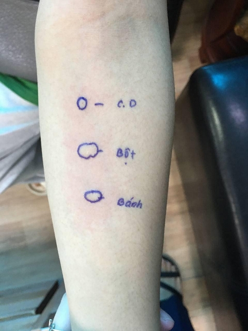 Sốc phản vệ bột mì, cô gái trẻ ngất xỉu