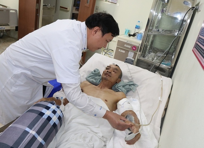 Người đàn ông bị đứt rời cánh tay sau khi ngã giàn giáo