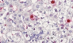 Bất ngờ phát hiện virus mới gây bệnh viêm gan ở người