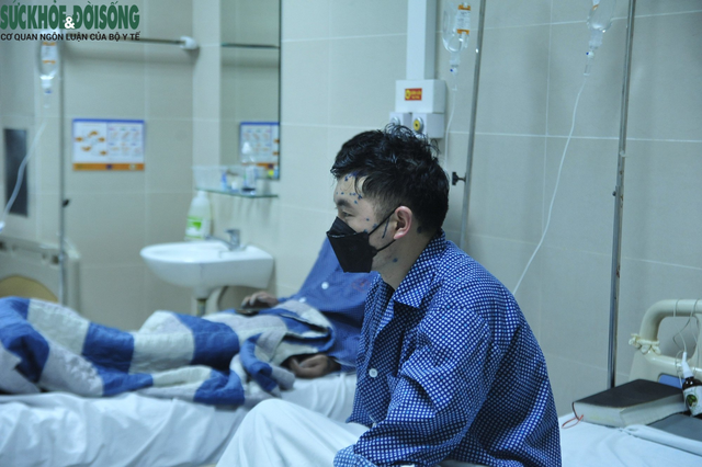 Hà Nội xuất hiện bệnh thủy đậu trái mùa bất thường