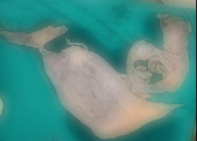 Người phụ nữ mất toàn bộ da đầu khi đang khoan giếng