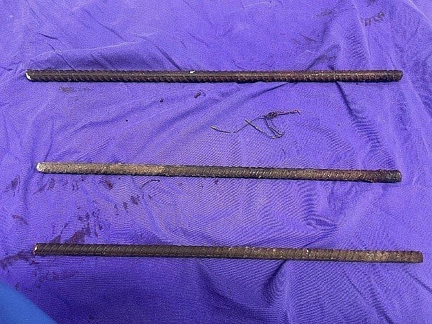 Nam công nhân bị ngã vào 3 cọc sắt khi đang lao động