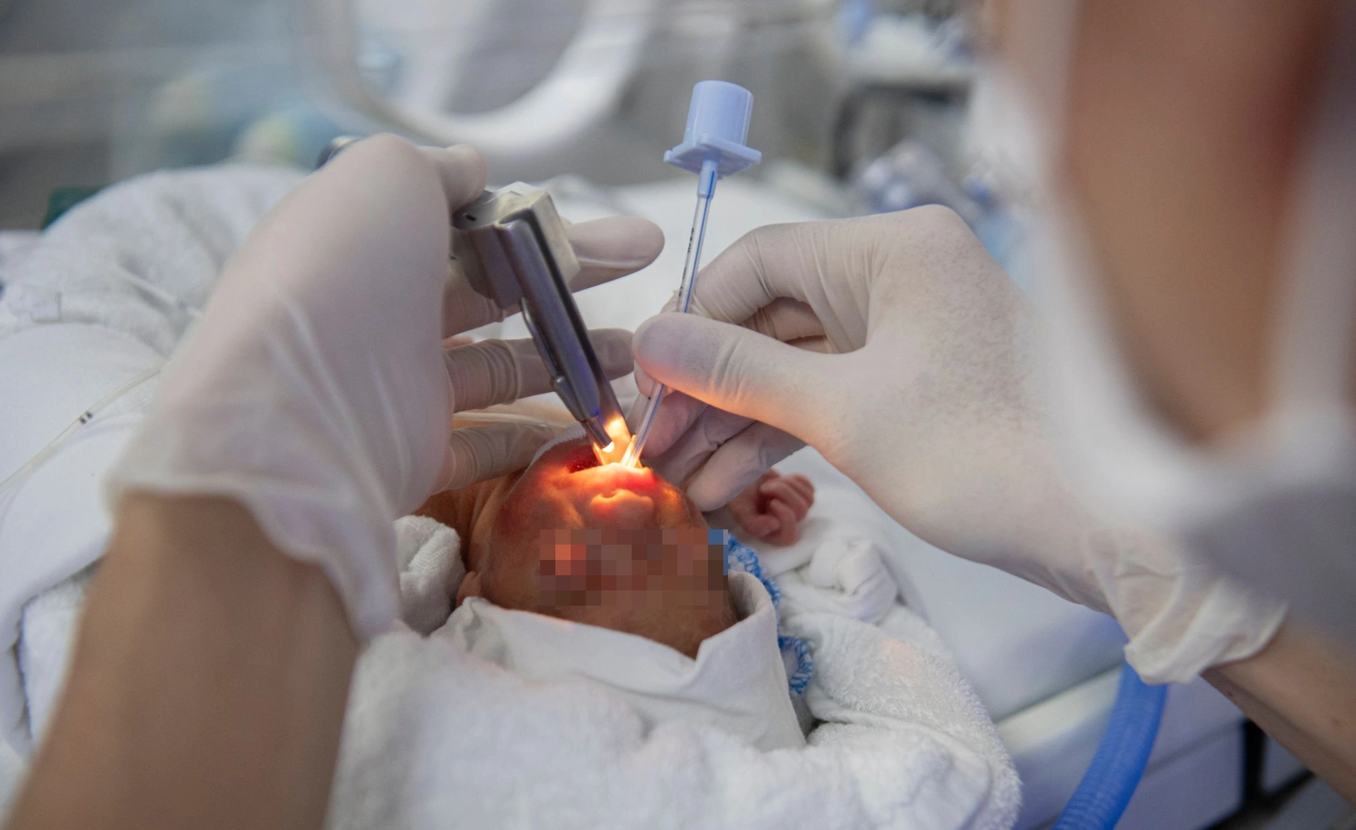 Hành trình sinh tử về vòng tay mẹ của những bệnh nhân "0 tuổi"