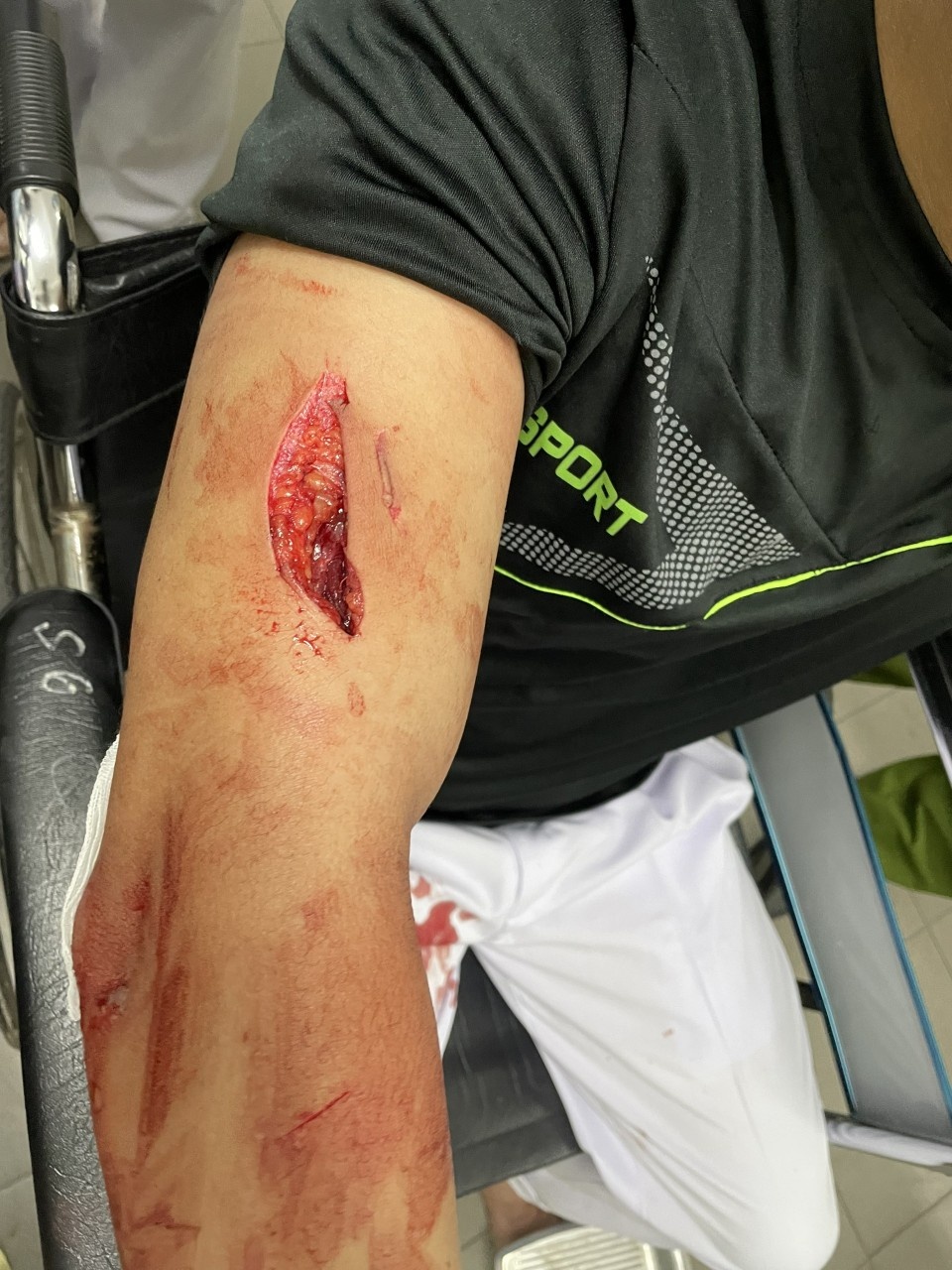 Nhân viên y tế lại bị hành hung: Vấn nạn đáng báo động