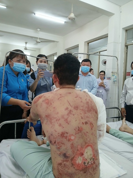 Từ vụ nổ lò hơi ở Đồng Nai: Trách nhiệm của doanh nghiệp và cấp quản lý?