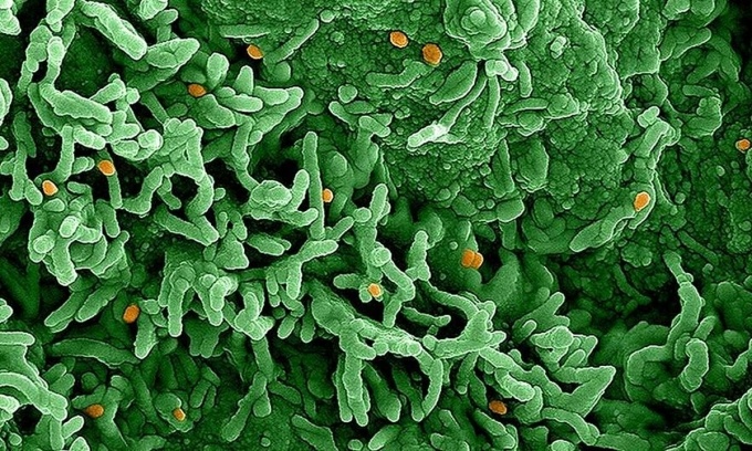 Bệnh đậu mùa khỉ nguy hiểm như thế nào?