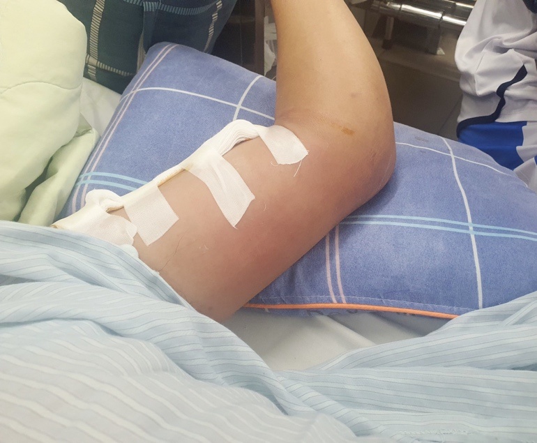 Lao động thường xuyên tiếp xúc bùn đất: Cảnh giác với 