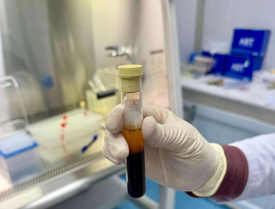 Quảng Bình: Lần đầu ứng dụng keo dán sinh học trong phẫu thuật mắt an toàn