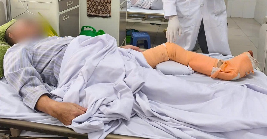 Dán cao, xoa dầu sau ngã: Người đàn ông suýt mất chân vì hoại tử