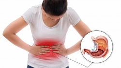 Vì sao công nhân dễ mắc bệnh dạ dày?