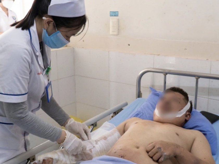 Sức khỏe các nạn nhân trong vụ nổ tại Công ty SGI Vina hiện nay ra sao?