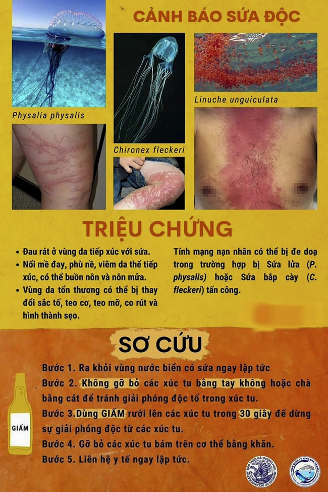 Viêm da tiếp xúc do Sứa biển: Cách nhận biết và sơ cứu đúng cách