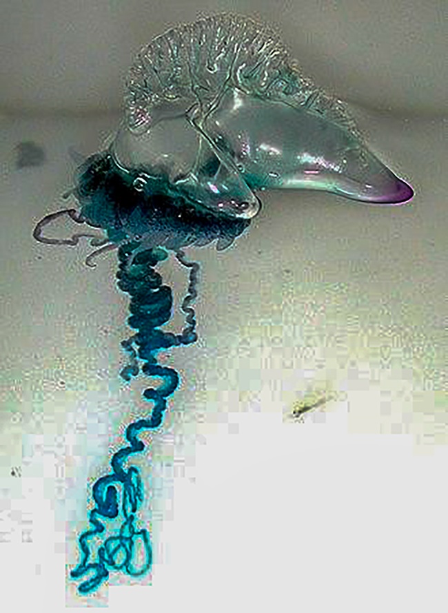 Viêm da tiếp xúc do Sứa biển: Cách nhận biết và sơ cứu đúng cách