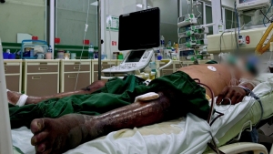 "Suýt mất chân, mất mạng" vì nghề tôm