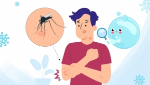 Sốt xuất huyết bước vào mùa cao điểm, nguy cơ tử vong nếu không điều trị kịp thời