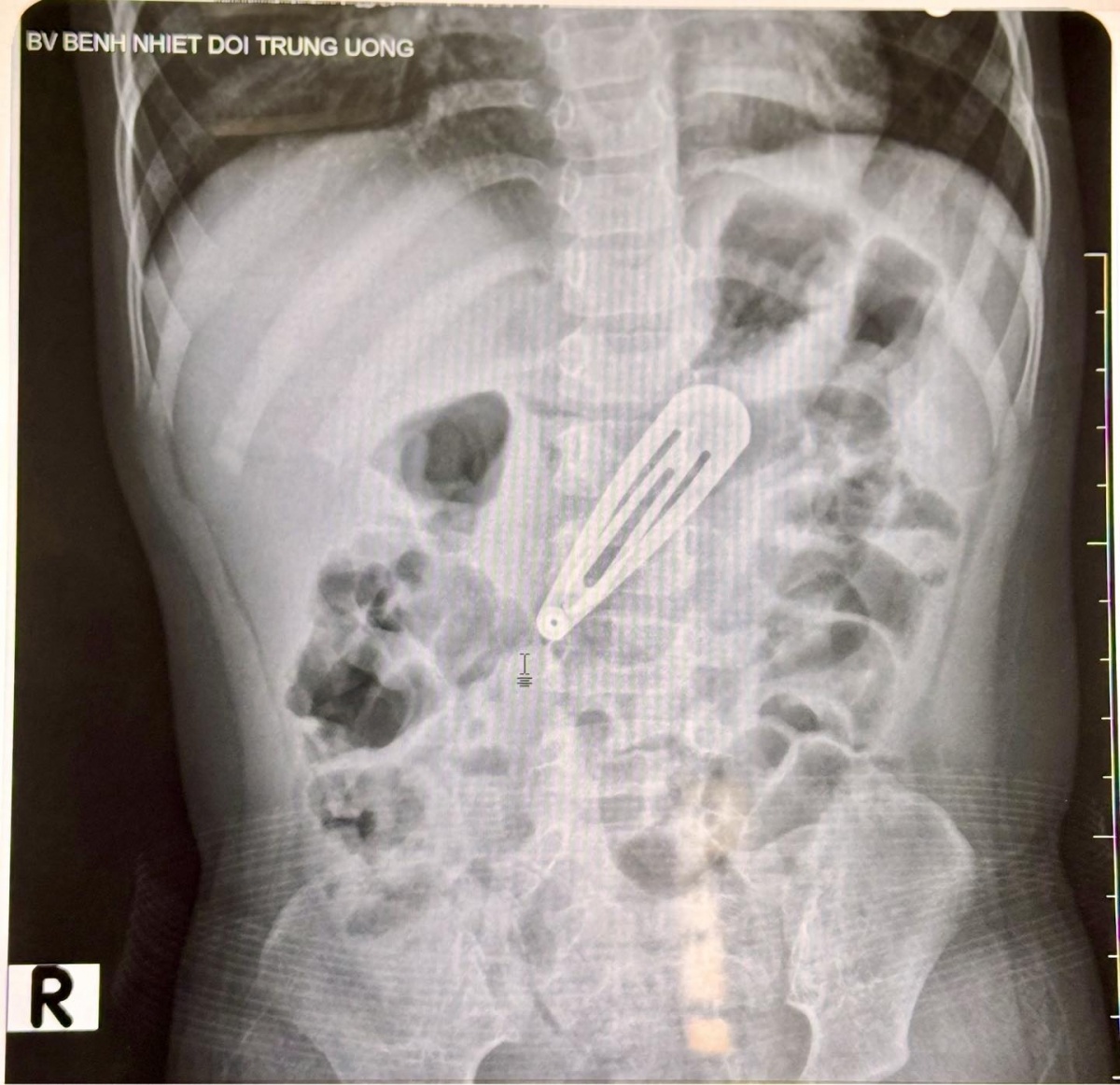 Nỗi sợ mang tên “nghỉ hè”: Khi mùa vui trở thành mùa nguy hiểm