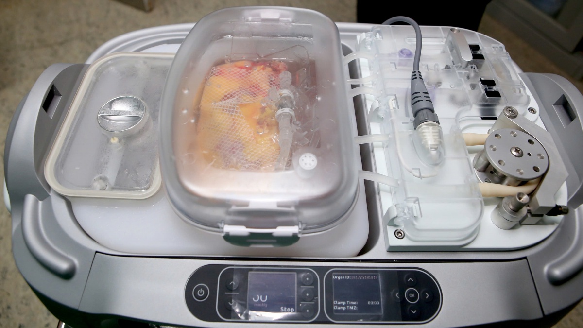 Lần đầu tiên ứng dụng máy bảo quản LifePort trong ghép thận, dấu mốc mới của ngành Y