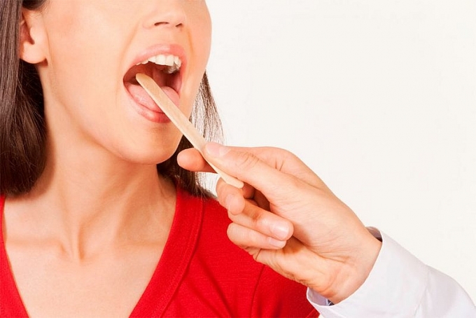 nguyen nhan gay viem hong hat thuong gap va cach phong benh don gian