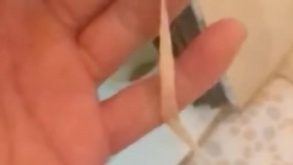 Sán dây dài 3 mét “tấn công” đường ruột vì thói quen ăn rau sống