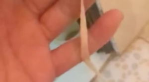 Sán dây dài 3 mét “tấn công” đường ruột vì thói quen ăn rau sống